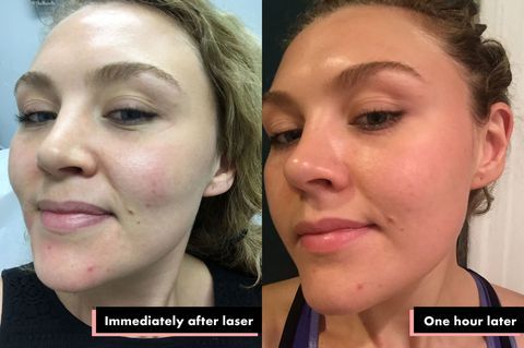 SUNSHINE COSMETIC CLINIC & MEDI SPA