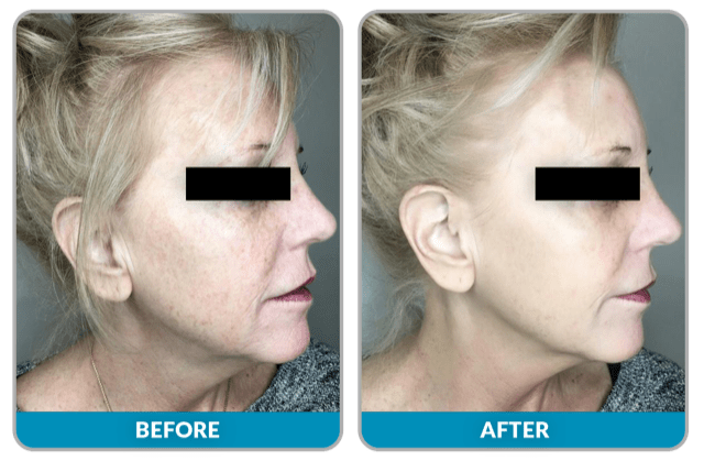 SUNSHINE COSMETIC CLINIC & MEDI SPA