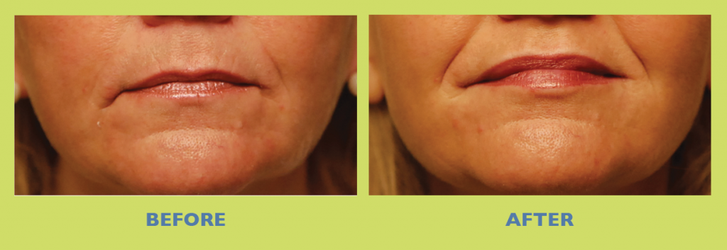 SUNSHINE COSMETIC CLINIC & MEDI SPA