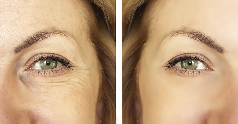 SUNSHINE COSMETIC CLINIC & MEDI SPA