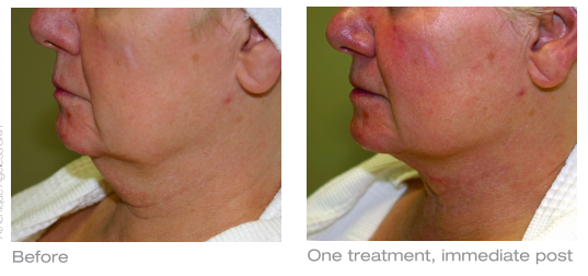 SUNSHINE COSMETIC CLINIC & MEDI SPA