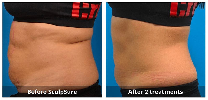 SUNSHINE COSMETIC CLINIC & MEDI SPA
