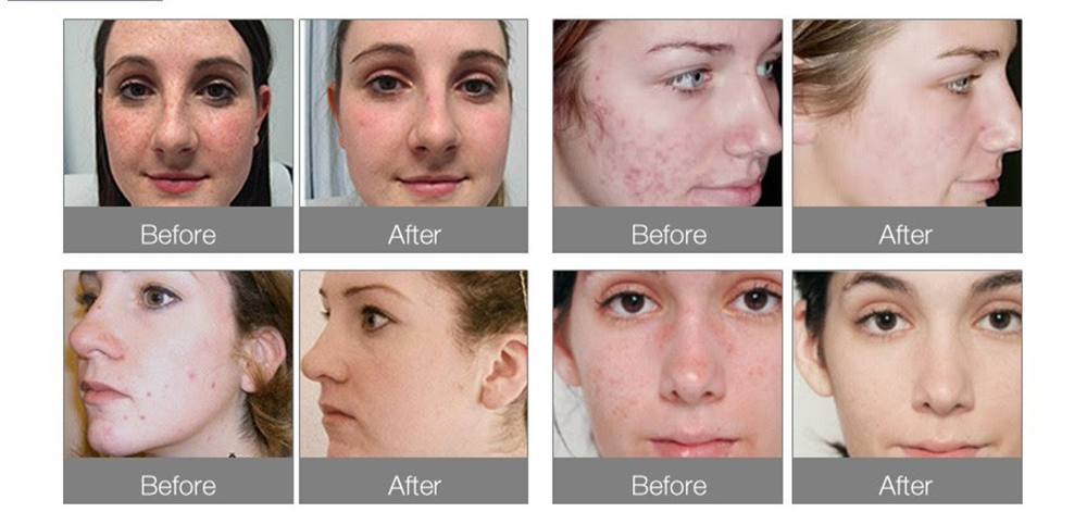 SUNSHINE COSMETIC CLINIC & MEDI SPA