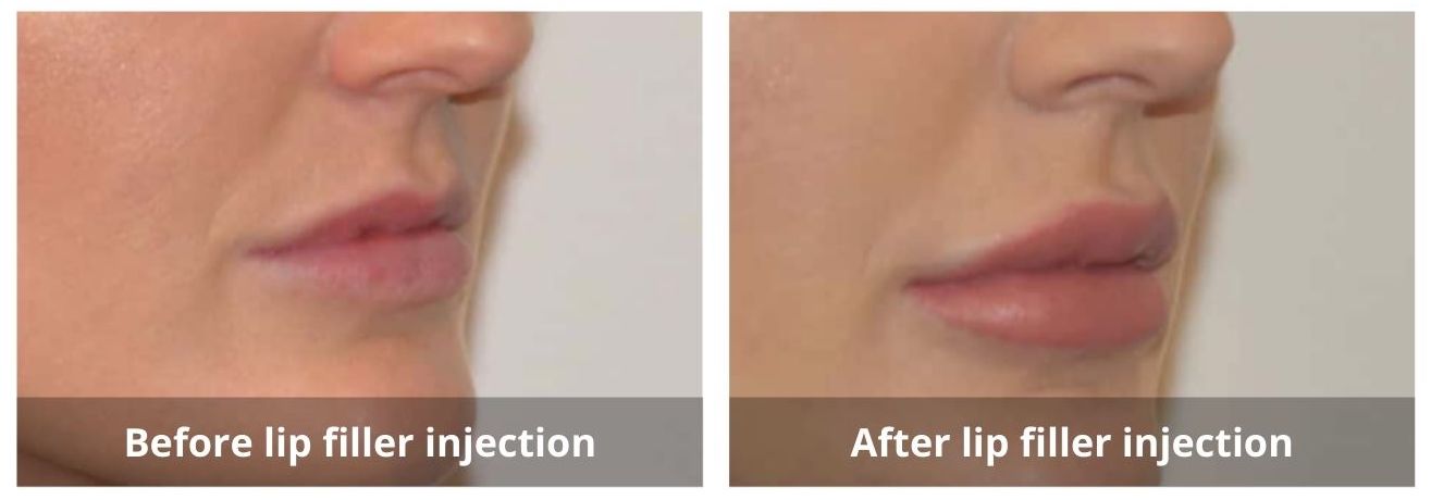SUNSHINE COSMETIC CLINIC & MEDI SPA