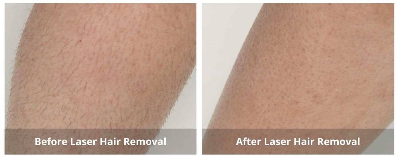 SUNSHINE COSMETIC CLINIC & MEDI SPA