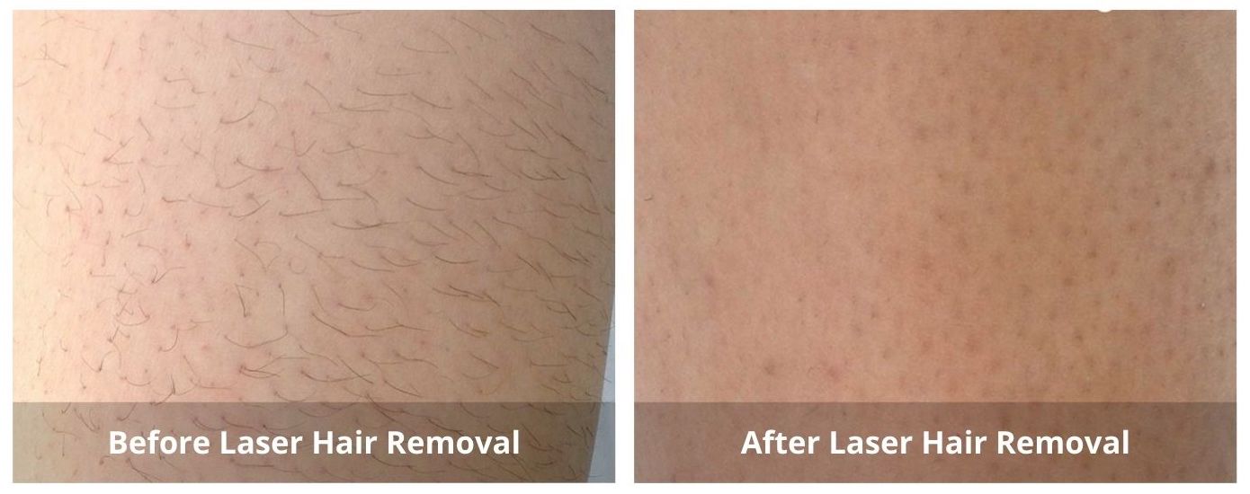 SUNSHINE COSMETIC CLINIC & MEDI SPA