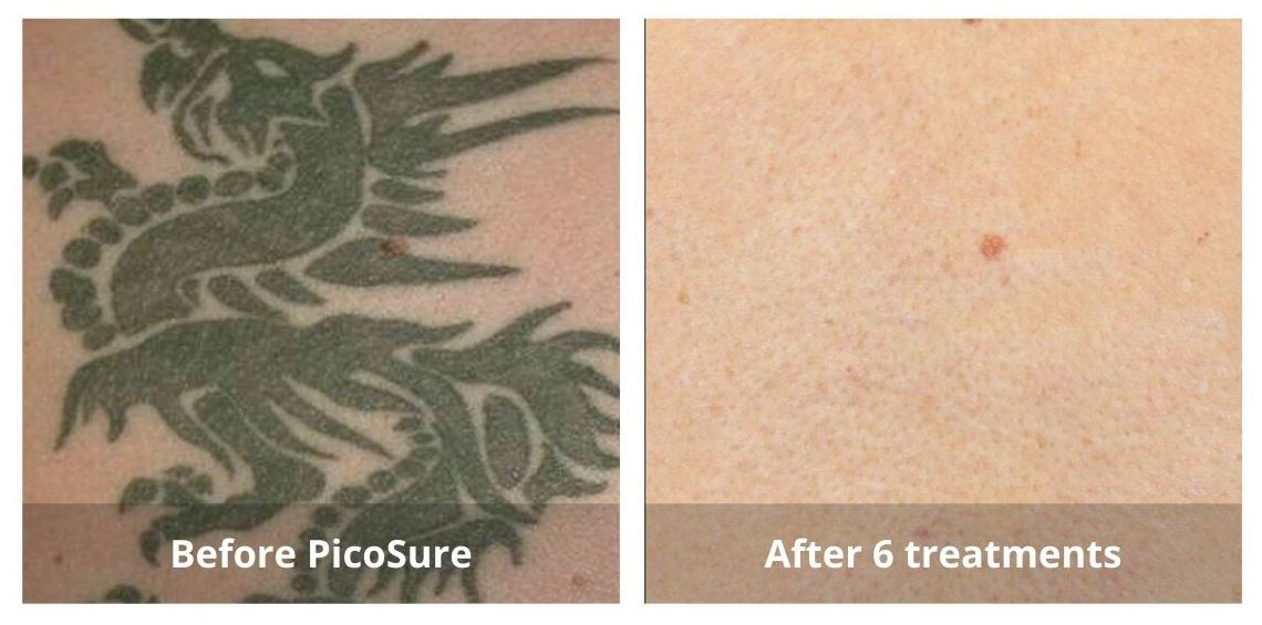 SUNSHINE COSMETIC CLINIC & MEDI SPA
