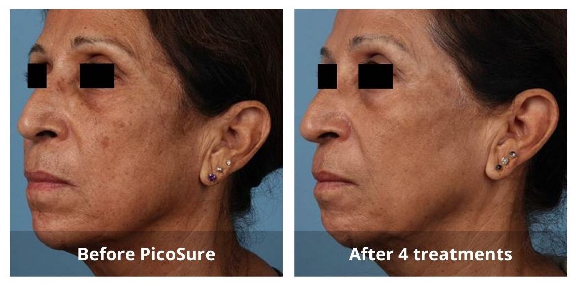 SUNSHINE COSMETIC CLINIC & MEDI SPA