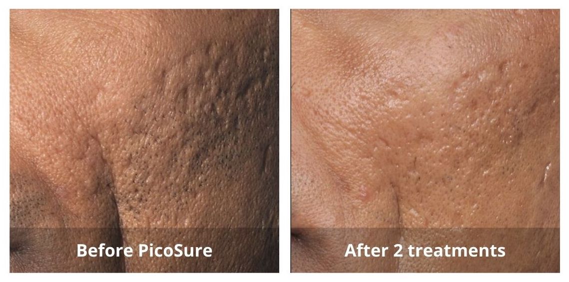SUNSHINE COSMETIC CLINIC & MEDI SPA