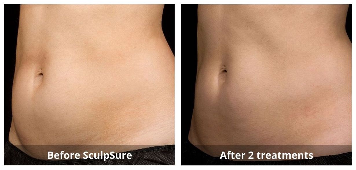 SUNSHINE COSMETIC CLINIC & MEDI SPA