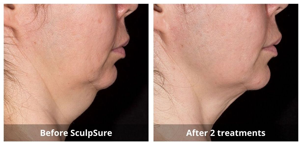 SUNSHINE COSMETIC CLINIC & MEDI SPA