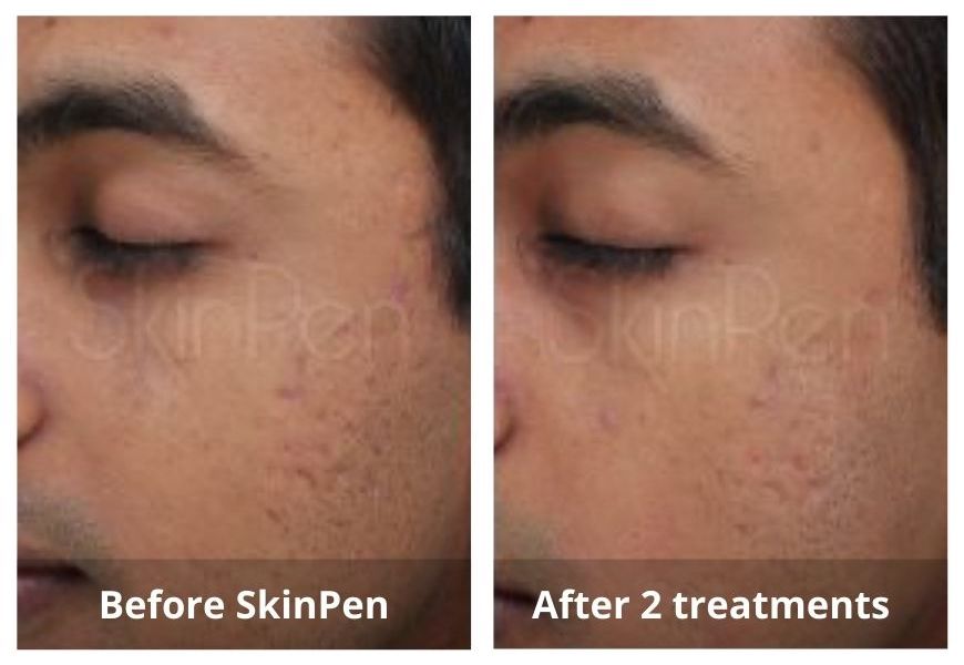 SUNSHINE COSMETIC CLINIC & MEDI SPA