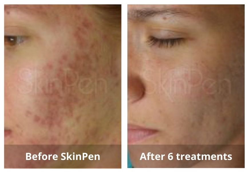 SUNSHINE COSMETIC CLINIC & MEDI SPA