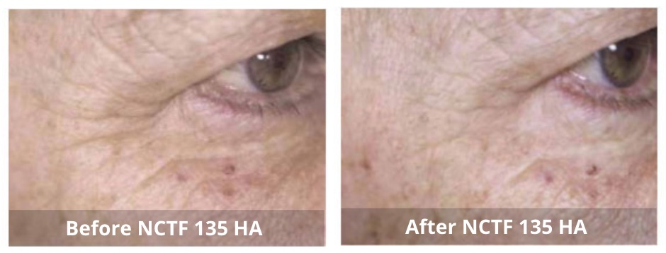 SUNSHINE COSMETIC CLINIC & MEDI SPA