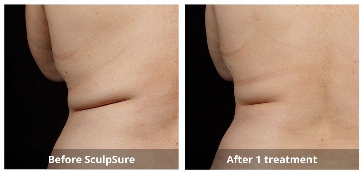 SUNSHINE COSMETIC CLINIC & MEDI SPA