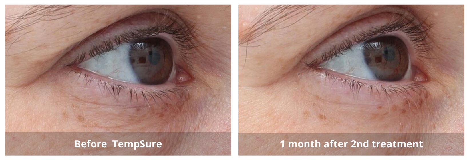 SUNSHINE COSMETIC CLINIC & MEDI SPA
