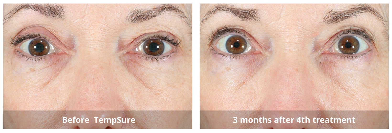 SUNSHINE COSMETIC CLINIC & MEDI SPA