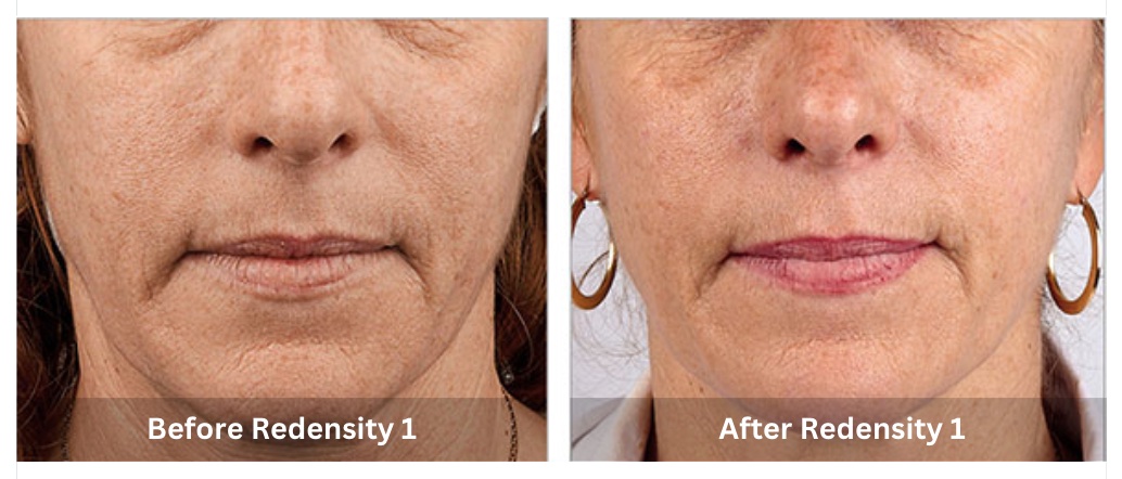 SUNSHINE COSMETIC CLINIC & MEDI SPA