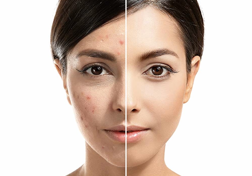 Facials in Waterloo Kitchener can provide many benefits to your skin and address a number of skin concerns.
