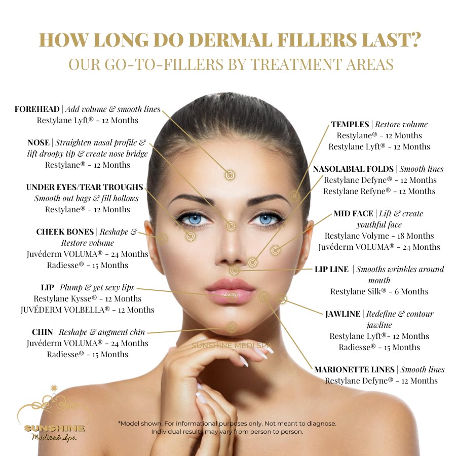 Typical time last for our go-to dermal fillers of different treatment areas