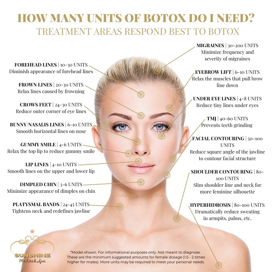 Recommended Botox injection dosage for our clients in Kitchener Waterloo area.