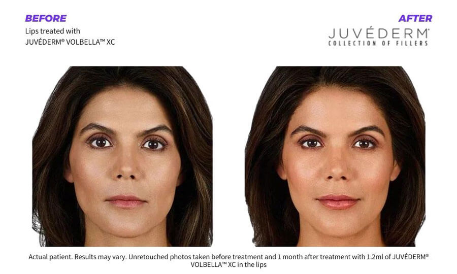 SUNSHINE COSMETIC CLINIC & MEDI SPA