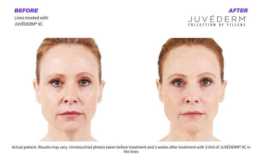SUNSHINE COSMETIC CLINIC & MEDI SPA