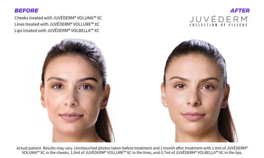 SUNSHINE COSMETIC CLINIC & MEDI SPA