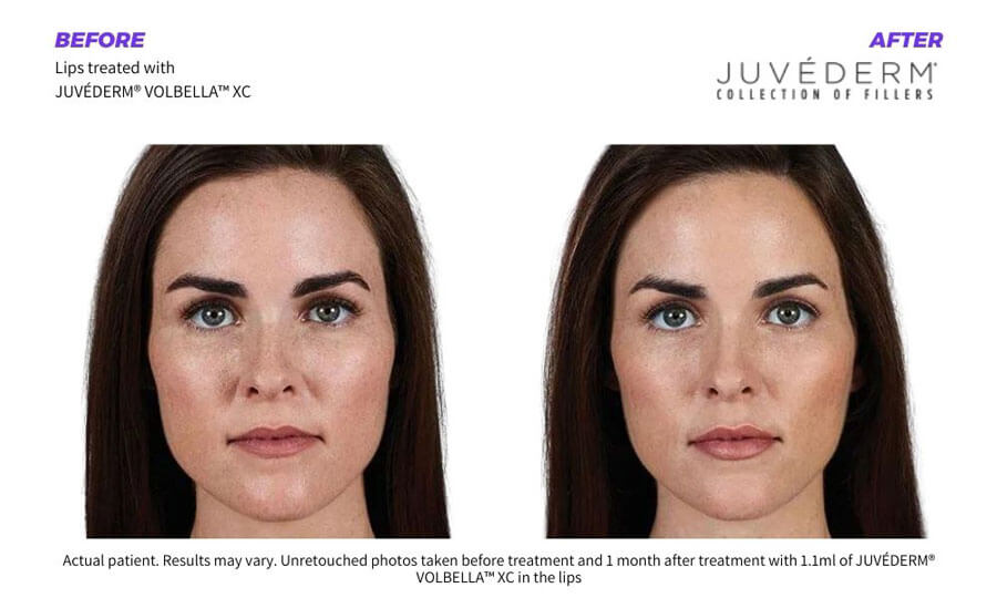 SUNSHINE COSMETIC CLINIC & MEDI SPA