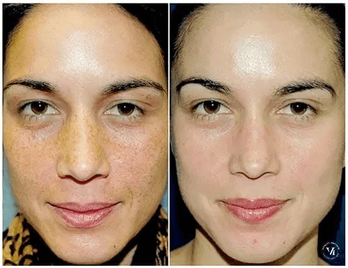 SUNSHINE COSMETIC CLINIC & MEDI SPA