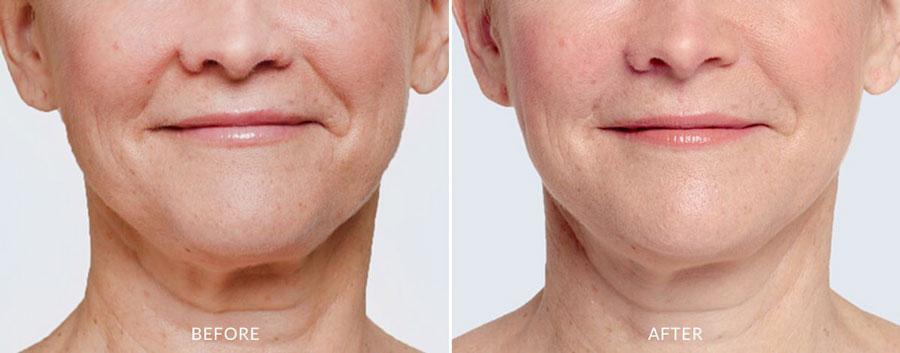 SUNSHINE COSMETIC CLINIC & MEDI SPA
