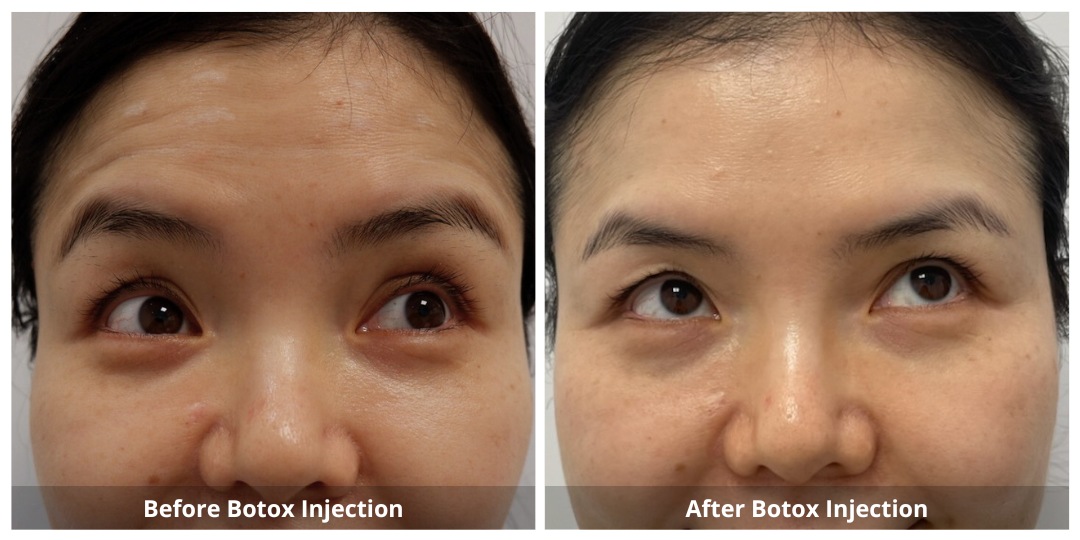 SUNSHINE COSMETIC CLINIC & MEDI SPA