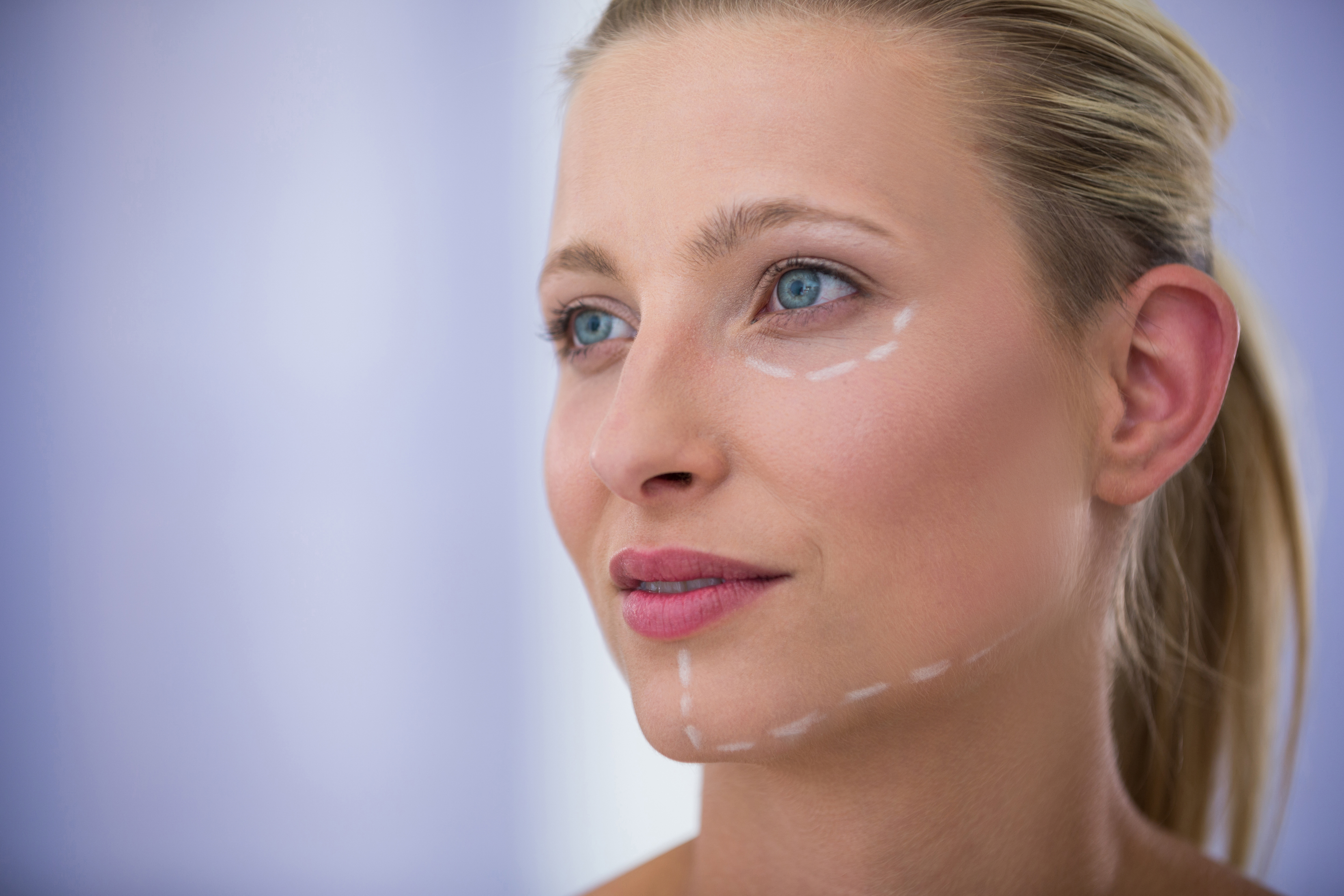 Fractora® treatment