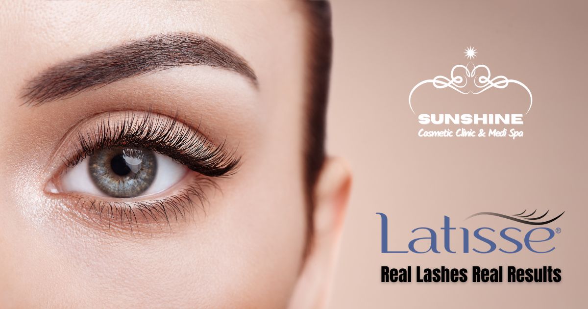 latisse treatment in waterloo kitchener